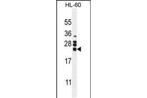 Western blot analysis in HL60 cell line lysates (35ug/lane). (GM-CSF 抗体  (AA 59-85))