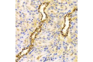 Immunohistochemistry of paraffin-embedded Rat kidney using CPT2 antibody at dilution of 1:100 (x400 lens). (CPT2 抗体)