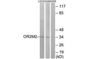 OR2M5 抗体  (AA 281-330)