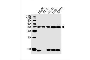 Western Blot at 1:1000 dilution Lane 1: HL-60 whole cell lysate Lane 2: A431 whole cell lysate Lane 3: Jurkat whole cell lysate Lane 4: Hela whole cell lysate Lane 5: A2058 whole cell lysate Lysates/proteins at 20 ug per lane. (Cytokeratin 28 抗体  (C-Term))