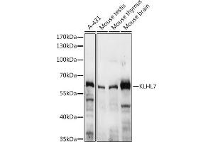 Western blot analysis of extracts of various cell lines, using KLHL7 antibody (ABIN7268080) at 1:3000 dilution. (KLHL7 抗体  (AA 200-300))