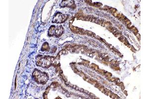 IHC analysis of MED9 using anti-MED9 antibody .