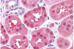Human Kidney: Formalin-Fixed, Paraffin-Embedded (FFPE) (DBT 抗体  (AA 35-84))