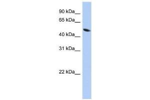 ZNF793 antibody used at 0. (ZNF793 抗体  (Middle Region))