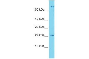 Host: Rabbit Target Name: APOPT1 Sample Type: Jurkat Whole Cell lysates Antibody Dilution: 1. (APOPT1 抗体  (C-Term))