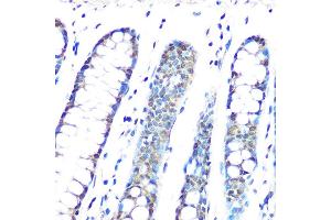 Immunohistochemistry of paraffin-embedded human colon using HP1 gamma/CBX3 Rabbit mAb (ABIN1679484, ABIN3018775, ABIN3018776 and ABIN7101659) at dilution of 1:100 (40x lens). (CBX3 抗体)