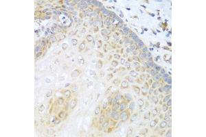Immunohistochemistry (Paraffin-embedded Sections) (IHC (p)) image for anti-Protein Kinase C, delta (PKCd) (AA 477-676) antibody (ABIN6146203)
