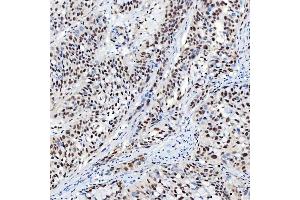 IHC analysis of SNRNP40 using anti-SNRNP40 antibody (ABIN7601719). (SNRNP40 抗体  (AA 43-357))