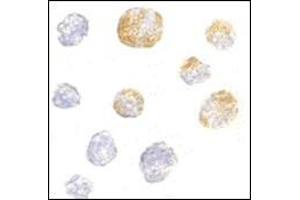 Immunocytochemistry of KIF5 in K562 cells with this product at 5 μg/ml. (KIF5A 抗体  (C-Term))