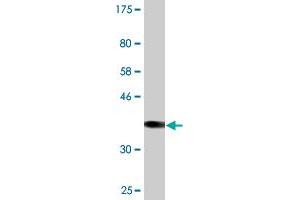 Western Blotting (WB) image for anti-Sulfotransferase Family, Cytosolic, 2B, Member 1 (SULT2B1) (AA 1-90) antibody (ABIN520615)