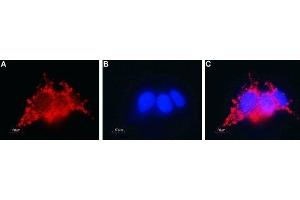 Expression of Connexin-26 in human HepG2 liver hepatocellular carcinoma cells - Immunocytochemical staining of fixed and permeabilized HepG2 liver hepatocellular carcinoma cells.