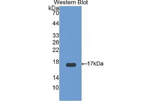 Western blot analysis of the recombinant protein. (UCP2 抗体  (AA 154-289))