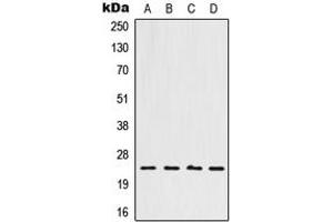 Western blot analysis of HOXB7 expression in A549 (A), HeLa (B), Raw264.
