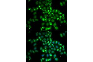Immunofluorescence analysis of HeLa cell using PCGF6 antibody. (PCGF6 抗体)
