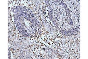 IHC analysis of GLUL using anti-GLUL antibody (ABIN7602403).