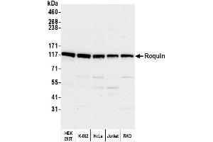Western Blotting (WB) image for anti-Ring Finger and CCCH-Type Domains 1 (RC3H1) (C-Term) antibody (ABIN7451565)