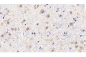 Detection of TNFa in Mouse Cerebrum Tissue using Polyclonal Antibody to Tumor Necrosis Factor Alpha (TNFa) (TNF alpha 抗体  (AA 80-235))