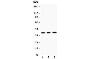 Western blot testing of Nkx2-5 antibody and Lane 1:  mouse spleen;  2: mouse heart;  3: human HeLa lysate. (NK2 Homeobox 5 抗体  (Middle Region))