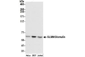 Western Blotting (WB) image for anti-Glomulin, FKBP Associated Protein (GLMN) (AA 544-594) antibody (ABIN7450284)