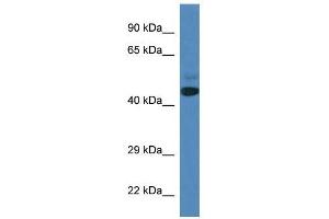 Western Blot showing SPRYD3 antibody used at a concentration of 1 ug/ml against Fetal Heart Lysate (SPRYD3 抗体  (N-Term))