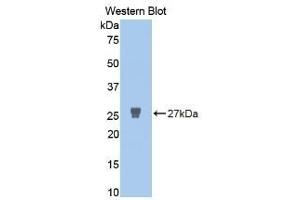 Detection of Recombinant MMP2, Human using Polyclonal Antibody to Matrix Metalloproteinase 2 (MMP2) (MMP2 抗体  (AA 445-660))