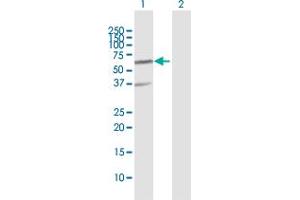 Western Blot analysis of RNF25 expression in transfected 293T cell line by RNF25 MaxPab polyclonal antibody. (RNF25 抗体  (AA 1-459))