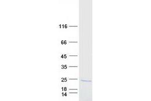 Western Blotting (WB) image for Phospholipase A2, Group XIIB (PLA2G12B) protein (Myc-DYKDDDDK Tag) (ABIN2729072)