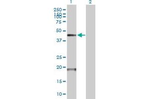 Western Blot analysis of TMPRSS11D expression in transfected 293T cell line by TMPRSS11D MaxPab polyclonal antibody. (TMPRSS11D 抗体  (AA 1-418))