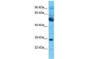 Host:  Rabbit  Target Name:  SLC13A5  Sample Type:  Thymus Tumor lysates  Antibody Dilution:  1. (SLC13A5 抗体  (Middle Region))