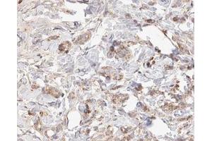 Immunohistochemistry (IHC) image for anti-S-Phase Kinase-Associated Protein 2 (SKP2) (C-Term) antibody (ABIN6265105)