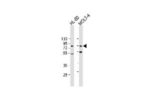 All lanes : Anti-CBFA2T3 Antibody at 1:500-1:2000 dilution Lane 1: HL-60 whole cell lysate Lane 2: MOLT-4 whole cell lysate Lysates/proteins at 20 μg per lane. (CBFA2T3 抗体  (AA 418-653))