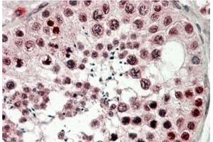 AP21512PU-N CIRBP antibody staining of paraffin embedded Human Testis at 3. (CIRBP 抗体  (C-Term))