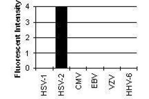 Cross Reactivity Results determined by IFA (HSV2 ICP8 抗体)