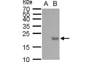 WB Image UBE2B antibody detects UBE2B protein by western blot analysis. (UBE2B 抗体)