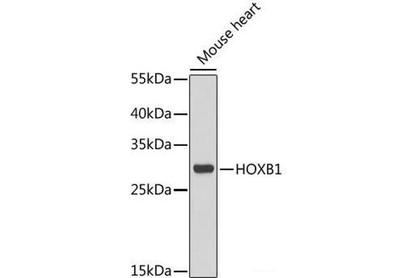 HOXB1 抗体