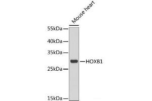 Western blot analysis of extracts of Mouse heart using HOXB1 Polyclonal Antibody at dilution of 1:1000. (HOXB1 抗体)