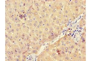 Immunohistochemistry of paraffin-embedded human liver tissue using ABIN7175166 at dilution of 1:100 (UGP2 抗体  (AA 1-497))