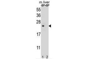 Western blot analysis of T4S4 Antibody (N-term) Pab pre-incubated without(lane 1) and with(lane 2) blocking peptide in liver cell line lysate. (TM4SF4 抗体  (N-Term))