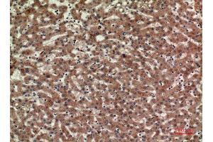 Immunohistochemistry (IHC) analysis of paraffin-embedded Human Liver, antibody was diluted at 1:100.