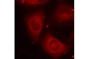 Immunofluorescence staining of methanol-fixed Hela cells using LIMK2(Phospho-Thr505) Antibody. (LIMK2 抗体  (pThr505))