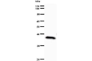 Western Blotting (WB) image for anti-Set1/Ash2 Histone Methyltransferase Complex Subunit ASH2 (ASH2L) antibody (ABIN933109) (ASH2L 抗体)