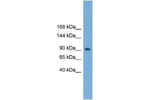 Human Placenta; WB Suggested Anti-ZNF226 Antibody Titration: 0. (ZNF226 抗体  (Middle Region))