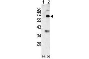 Image no. 2 for anti-Bone Morphogenetic Protein 3 (BMP3) (N-Term) antibody (ABIN357181) (BMP3 抗体  (N-Term))