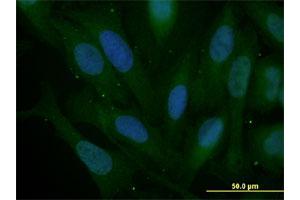 Immunofluorescence of monoclonal antibody to SNAI2 on U-2 OS cell.