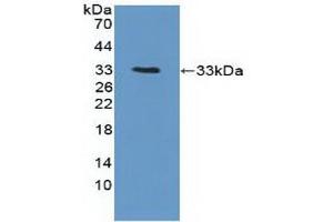 Detection of Recombinant PTK6, Human using Polyclonal Antibody to Protein Tyrosine Kinase 6 (PTK6) (PTK6 抗体  (AA 191-445))