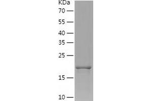 Western Blotting (WB) image for Fibroblast Growth Factor 8 (Androgen-Induced) (FGF8) (AA 23-215) protein (His tag) (ABIN7122949) (FGF8 Protein (AA 23-215) (His tag))