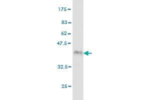 Western Blot detection against Immunogen (36. (IRAK2 抗体  (AA 111-210))