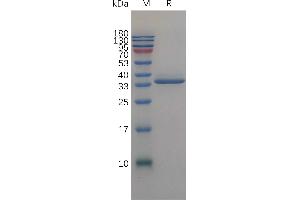 Insulin-Like Growth Factor Binding Protein 2, 36kDa (IGFBP2) (AA 36-325) protein (His tag)