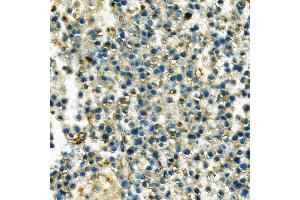 IHC analysis of Hexokinase 1/HK1 using anti-Hexokinase 1/HK1 antibody (ABIN7600259).