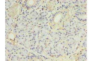 Immunohistochemistry of paraffin-embedded human pancreatic tissue using ABIN7142054 at dilution of 1:100 (PLCD4 抗体  (AA 1-762))